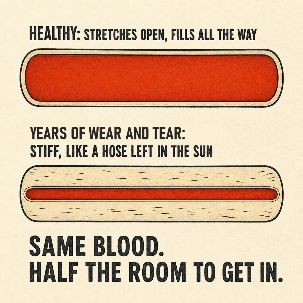 Diagram: a healthy blood vessel stretches open and fills all the way; after years of wear and tear it is stiff like a hose left in the sun, with half the room for blood to get in